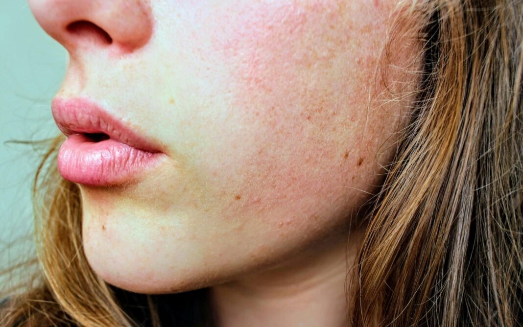 5 Best Homemade Anti-Ageing Face Masks for Glowing Skin