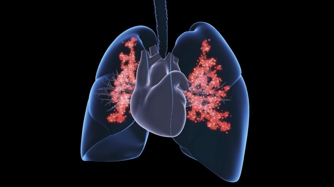 5 reasons why lung cancer is affecting non-smokers